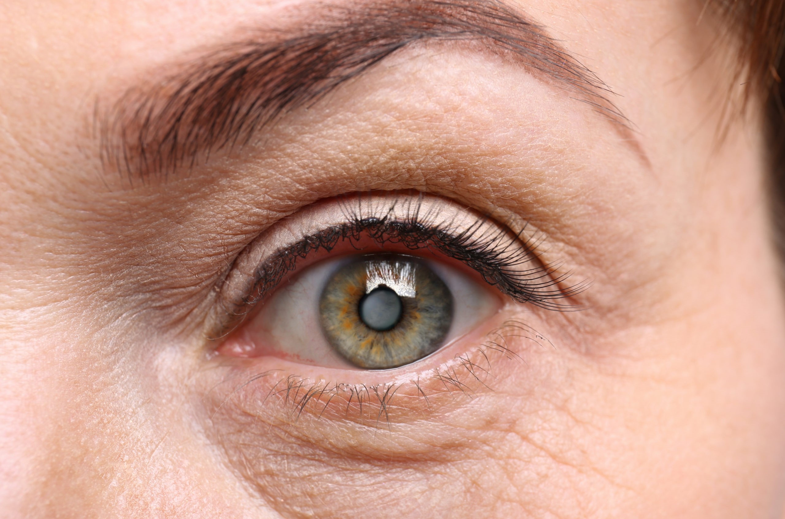 కంటిశుక్లం యొక్క కారణాలు మరియు లక్షణాలు – Causes and symptoms of cataracts