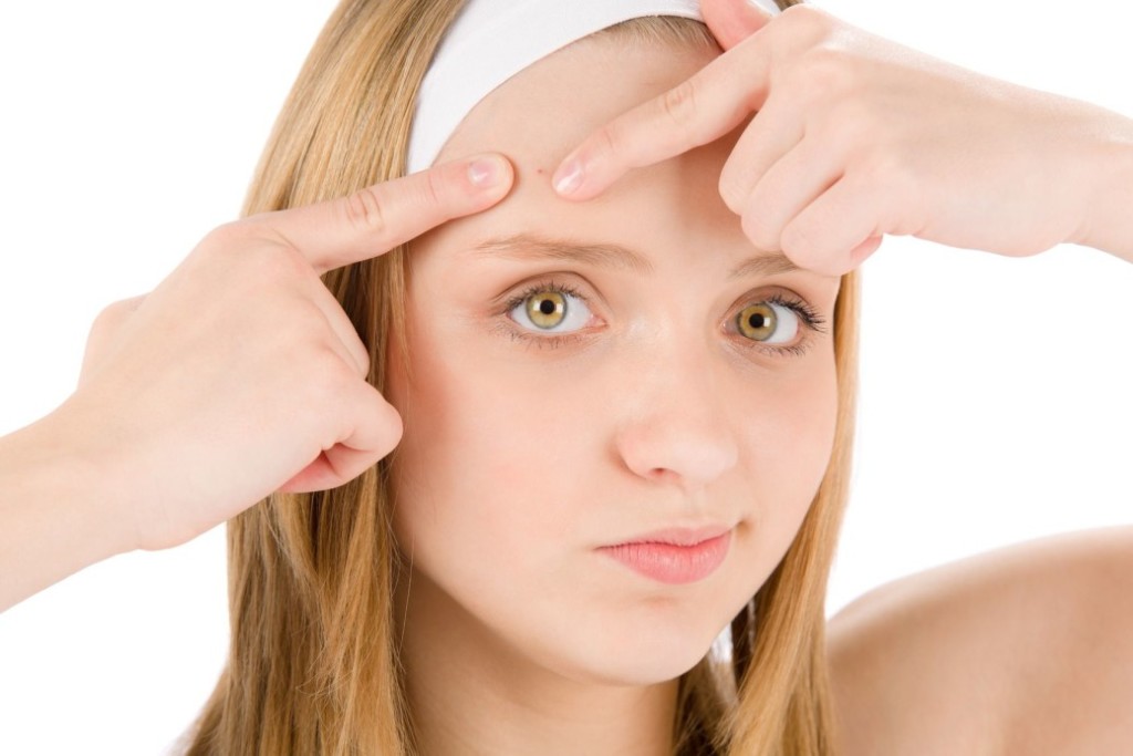 నుదిటిపై మొటిమలను నివారించే హోం రెమెడీస్ – Remedies for forehead pimples