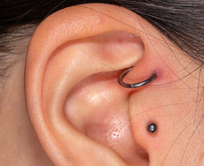 చెవి ఇన్ఫెక్షన్ నివారణకి హోం రెమెడీస్- Ear piercing infection?