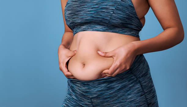 సిజేరియన్/సి-సెక్షన్ తర్వాత కొవ్వు తగ్గడం ఎలా – How to lose fat after cesarean/c-section
