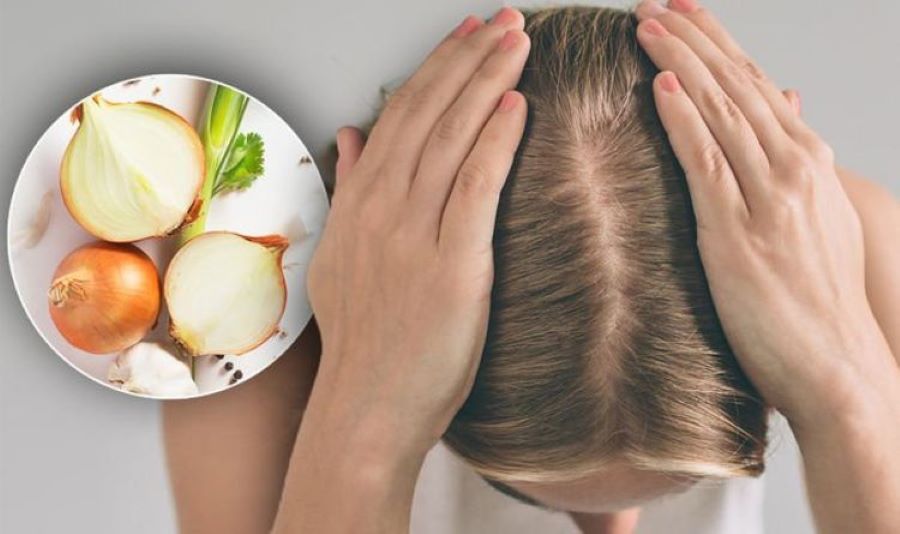 జుట్టు సంరక్షణ కోసం ఆనియన్ జ్యూస్ – Onion juice for hair care